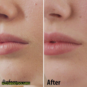 Facial Hair Remover