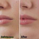 Facial Hair Remover
